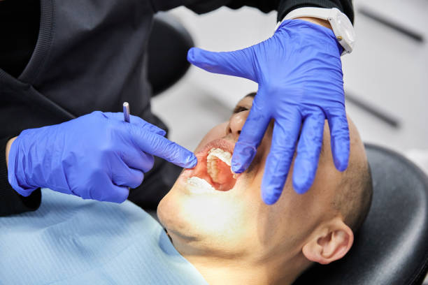 Best Same-Day Emergency Dental Services in Fort Lee, VA
